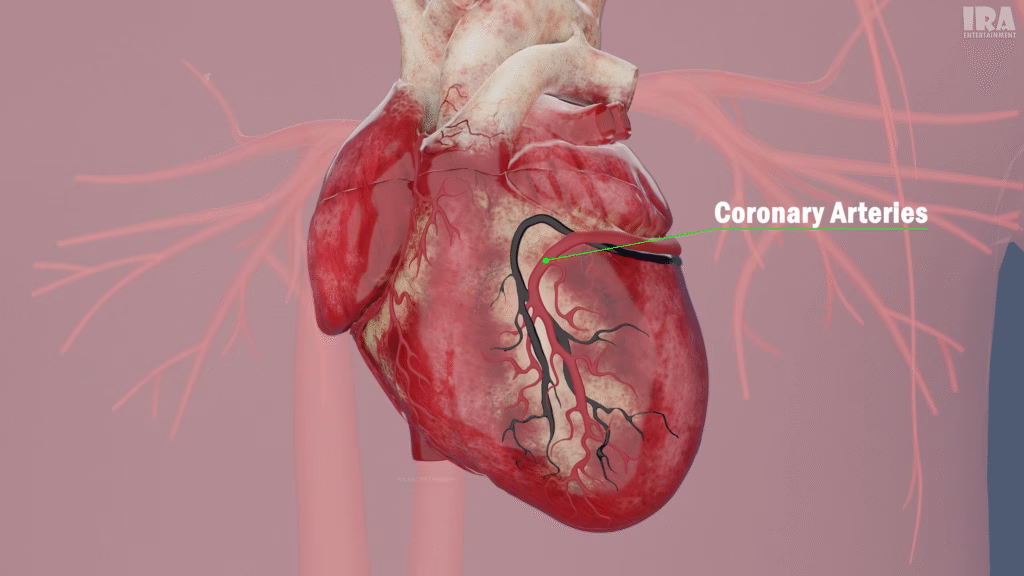 3D render of a human heart with the coronary artery highlighted for anatomical reference