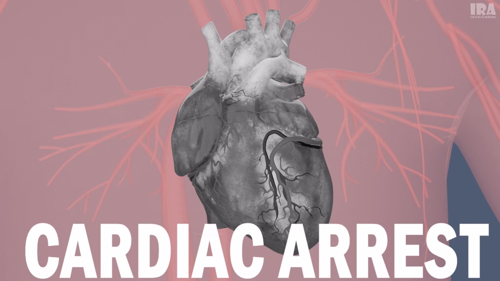 3D render of a human heart illustrating cardiac arrest with disrupted blood flow