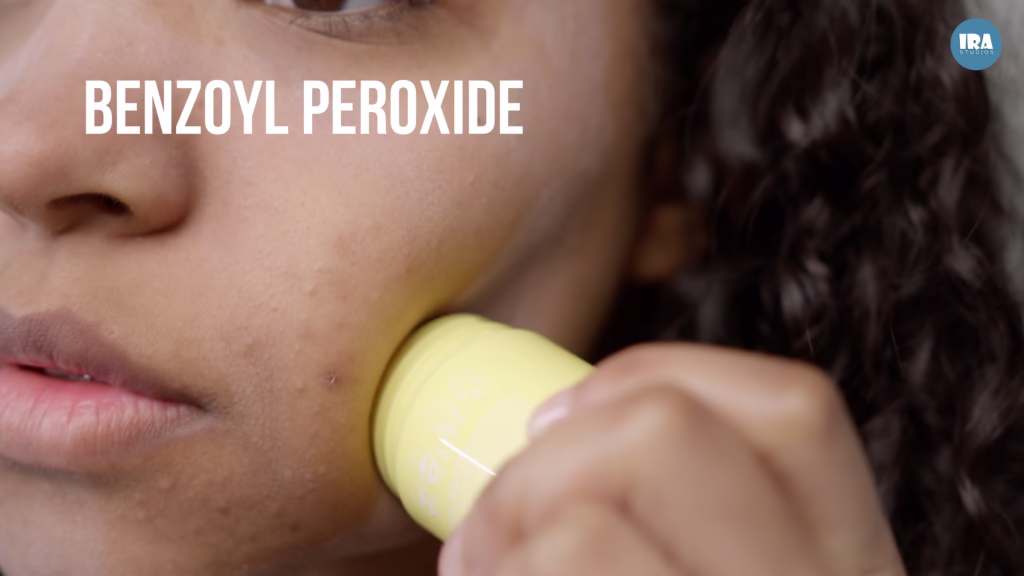 Effective Ways to Treat Acne