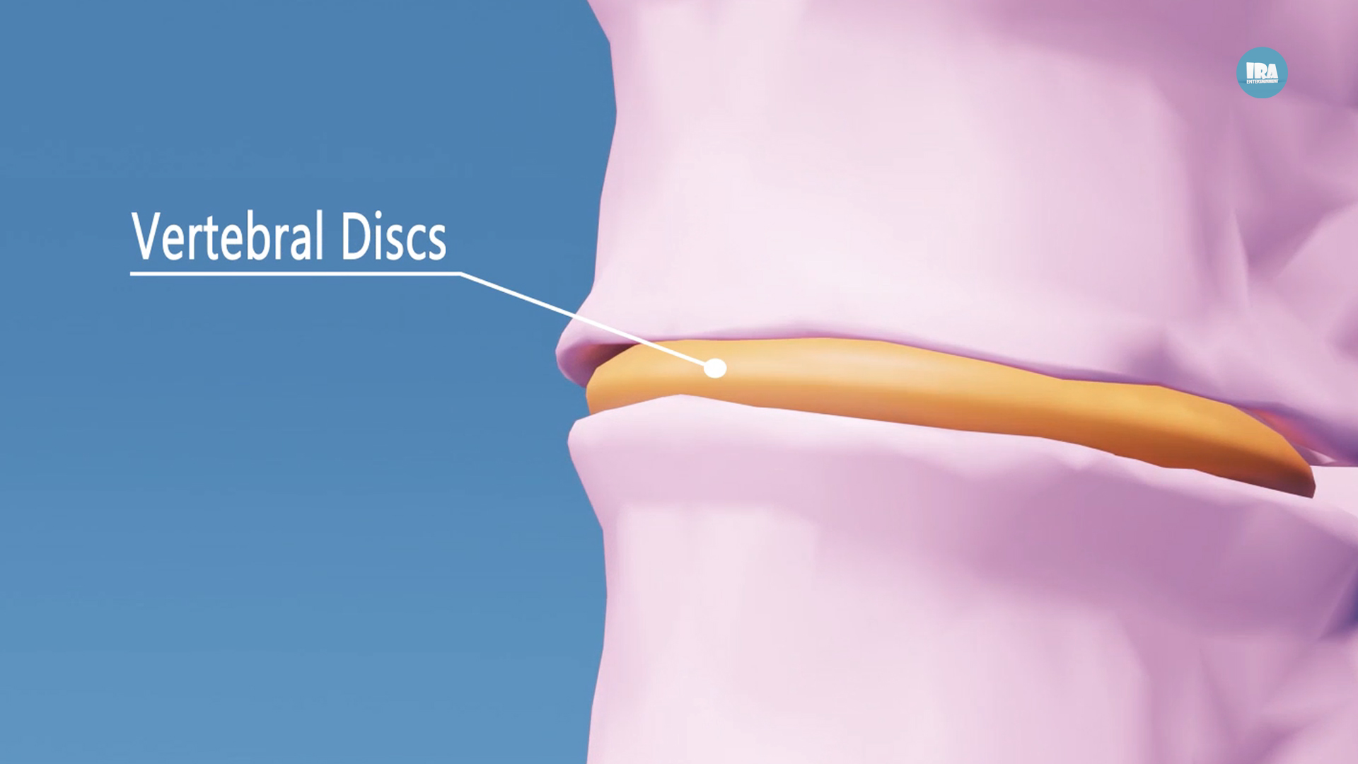 What Are Intervertebral Discs?