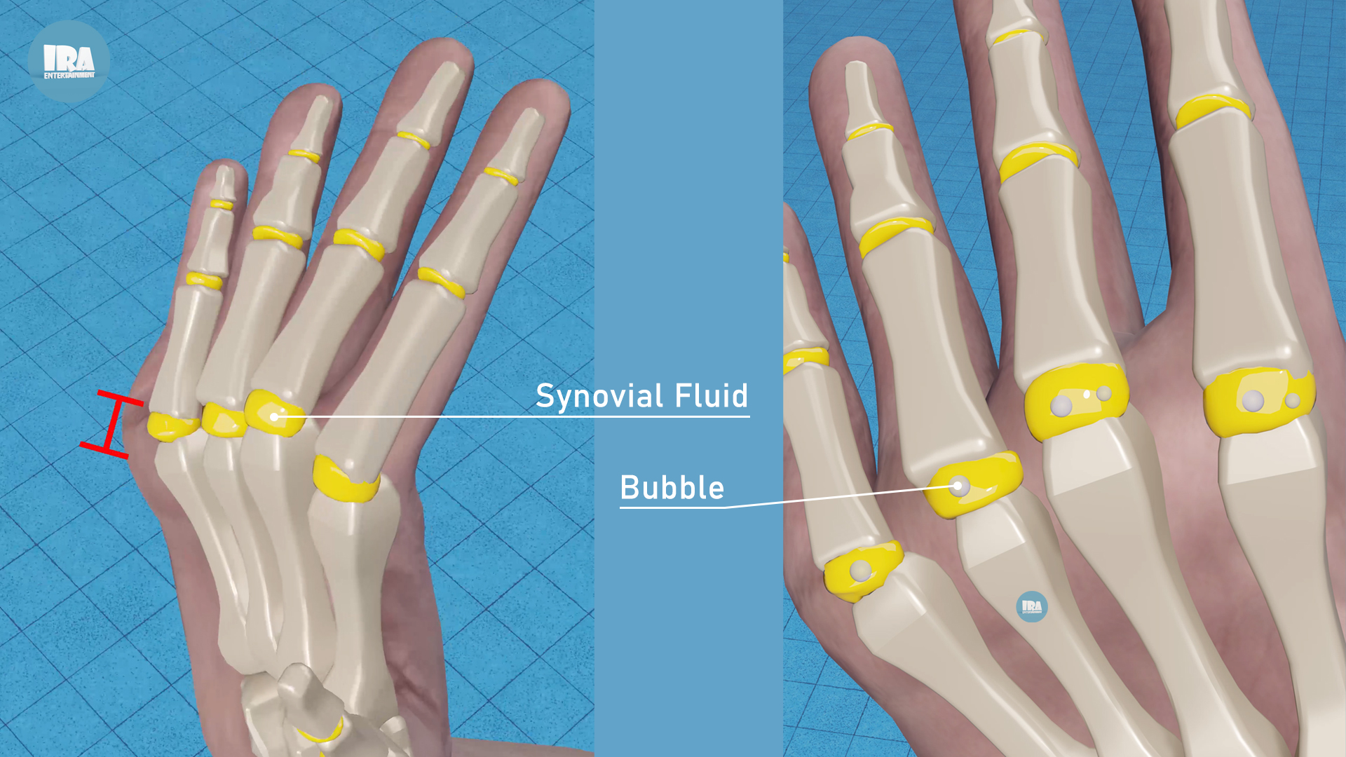 What Happens When You Crack Your Knuckles?