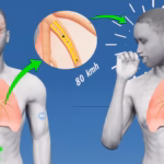 What Happens During a Cough?