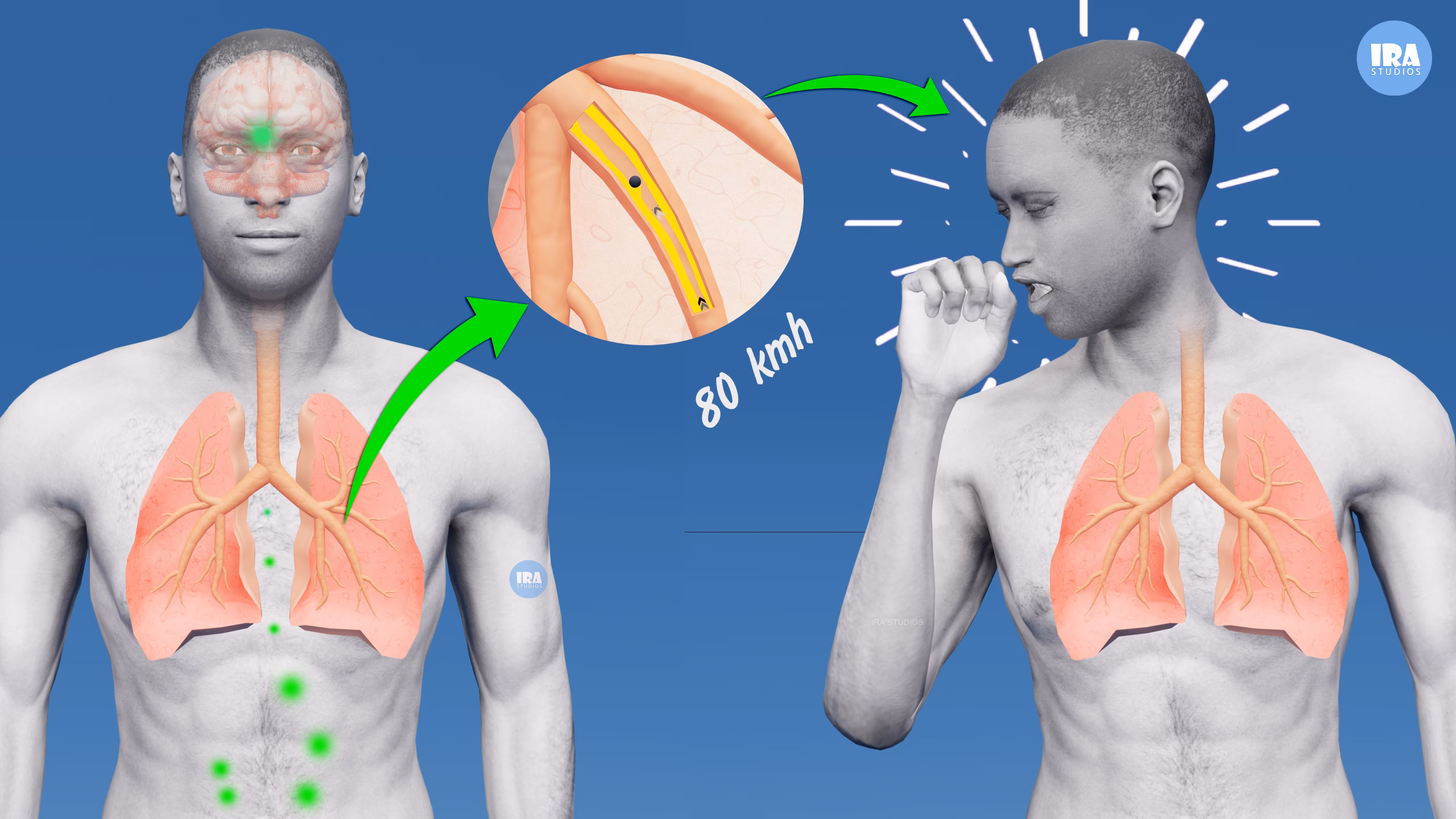 What Happens During a Cough?